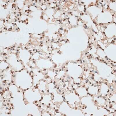 Immunohistochemistry-Paraffin: ZNF141 Antibody - Azide and BSA Free [NBP3-05597]